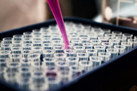 Immunoanalyses